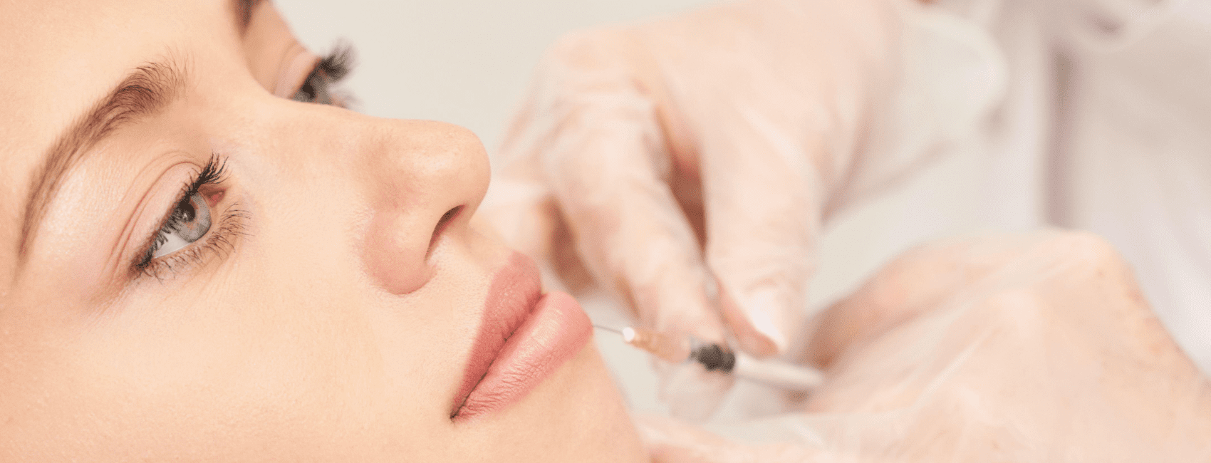 comblement des lèvres