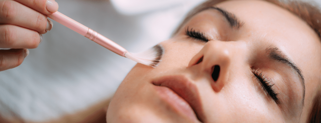Microneedling ou peeling chimique
