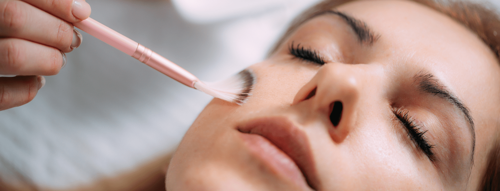 Microneedling ou peeling chimique